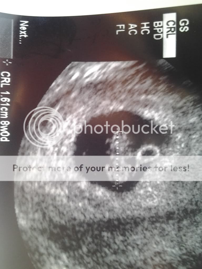 8 week ultrasound question. BabyCenter